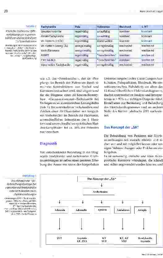 Vorschauseite 3: Arrhythmietherapie in der Intensivmedizin: Was ist notwendig, was überflüssig?