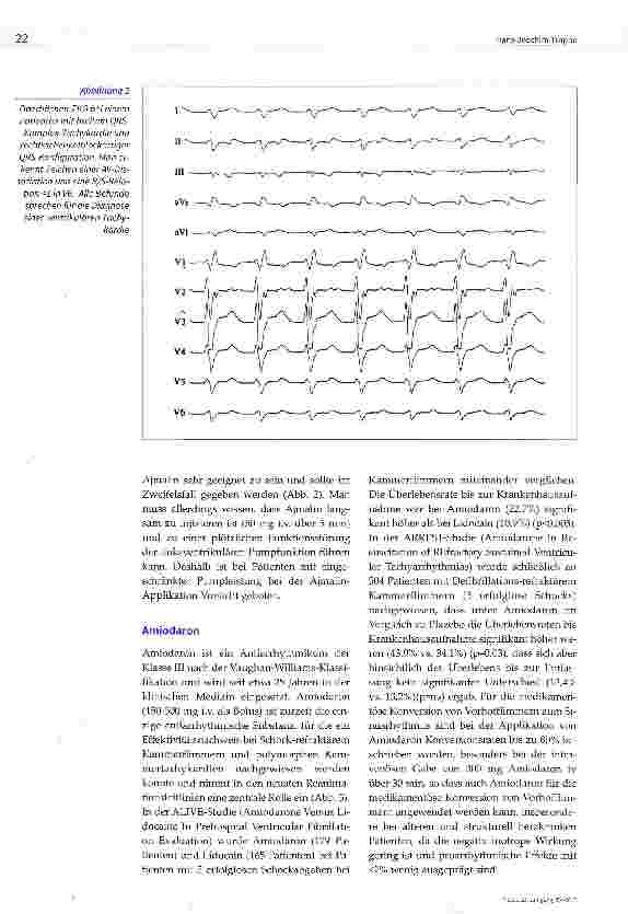 Vorschauseite 5: Arrhythmietherapie in der Intensivmedizin: Was ist notwendig, was überflüssig?