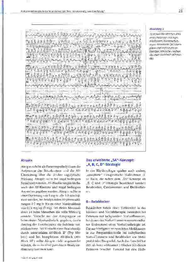 Vorschauseite 6: Arrhythmietherapie in der Intensivmedizin: Was ist notwendig, was überflüssig?