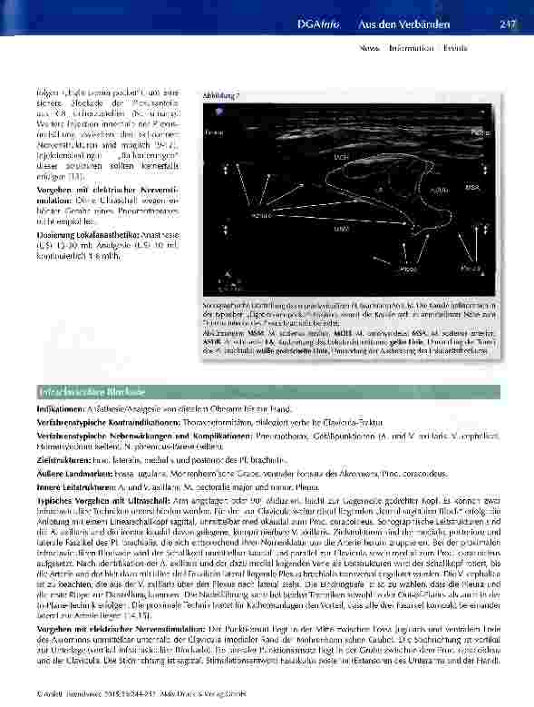 Vorschauseite 4: Periphere Blockaden der oberen Extremität