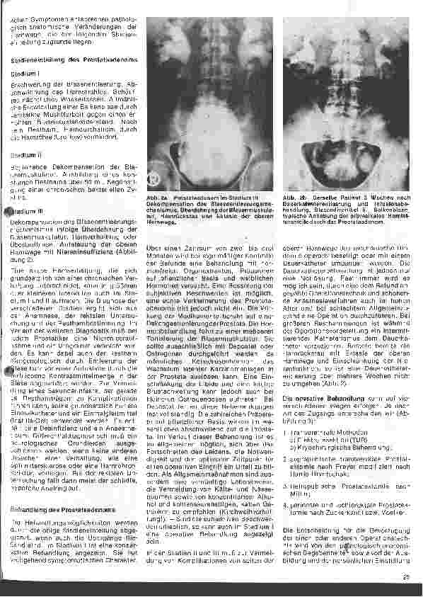 Vorschauseite 2: Urologie 4. Folge: Erkrankungen der Prostata, Untersuchung und Behandlung