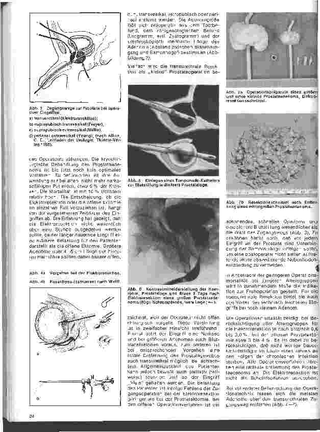Vorschauseite 3: Urologie 4. Folge: Erkrankungen der Prostata, Untersuchung und Behandlung