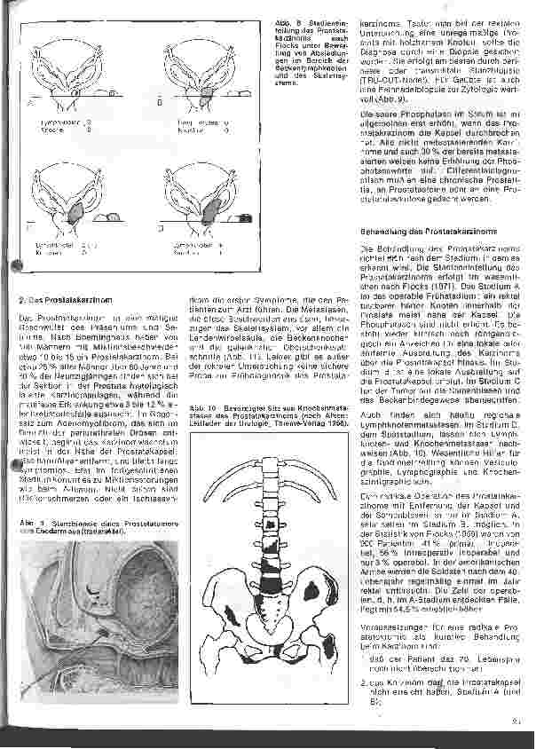 Vorschauseite 4: Urologie 4. Folge: Erkrankungen der Prostata, Untersuchung und Behandlung