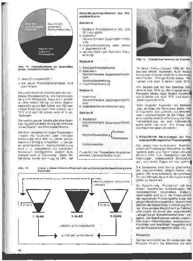 Vorschauseite 5: Urologie 4. Folge: Erkrankungen der Prostata, Untersuchung und Behandlung