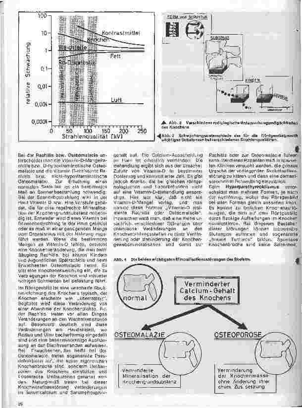 Vorschauseite 2: Radiologie 23. Folge: Die Knochentkalkung als Alterserscheinung und Krankheit // Radiologische Bestimmung des Knochenmineralgehaltes