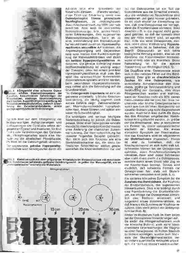 Vorschauseite 3: Radiologie 23. Folge: Die Knochentkalkung als Alterserscheinung und Krankheit // Radiologische Bestimmung des Knochenmineralgehaltes