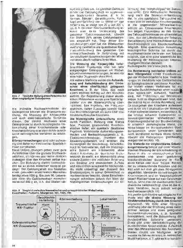 Vorschauseite 4: Radiologie 23. Folge: Die Knochentkalkung als Alterserscheinung und Krankheit // Radiologische Bestimmung des Knochenmineralgehaltes