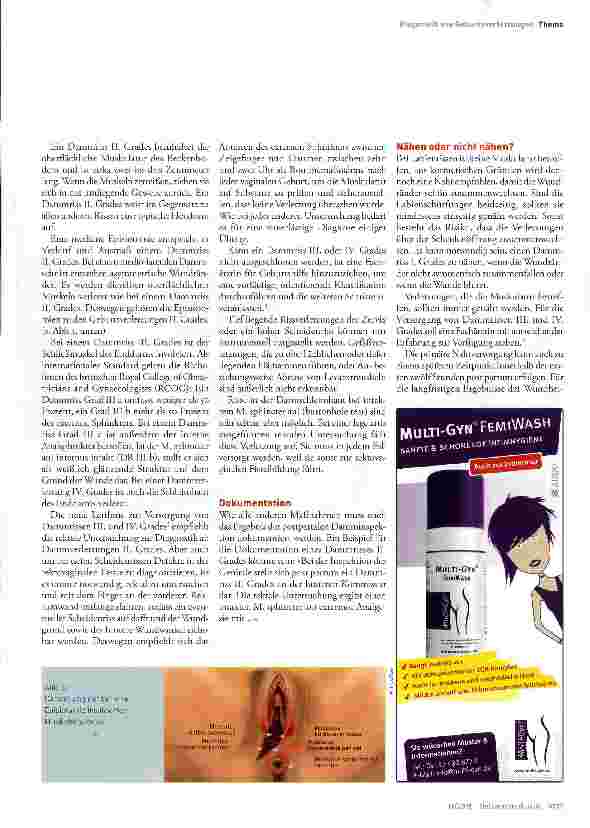 Vorschauseite 4: Diagnostik von Geburtsverletzungen