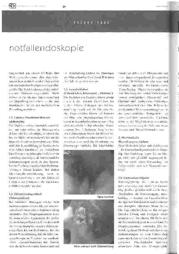 Vorschauseite 4: notfallendoskopie bei akuter blutung im gastrointestinaltrakteine pflegerische herausforderung