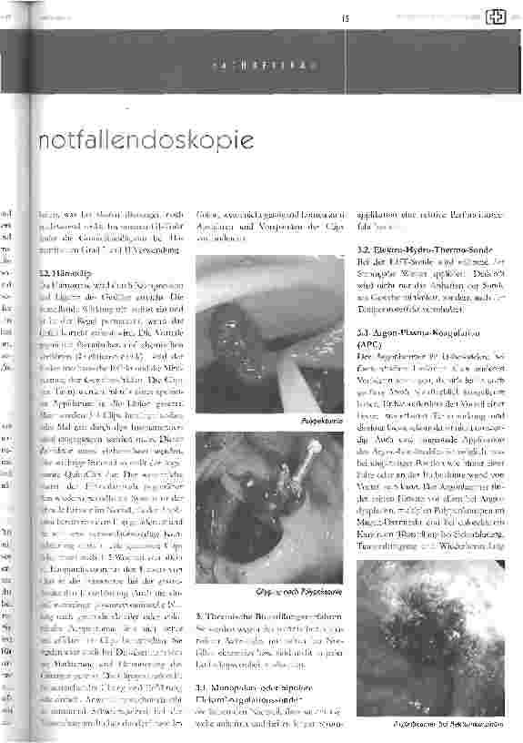 Vorschauseite 5: notfallendoskopie bei akuter blutung im gastrointestinaltrakteine pflegerische herausforderung