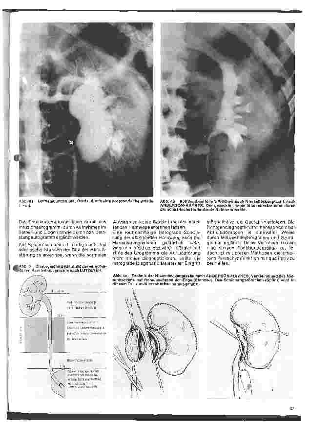Vorschauseite 2: Urologie 5. Folge: Harnablußstörungen