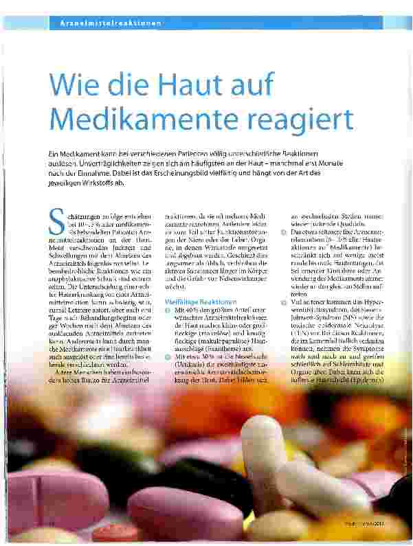 Vorschauseite 1: Wie die Haut auf Medikamente reagiert