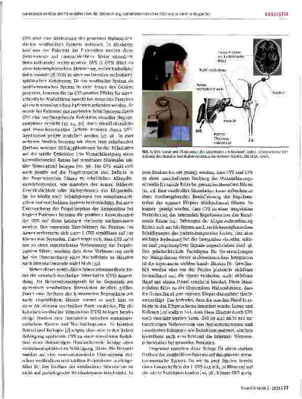 Vorschauseite 3: Galvanisch-vestibuläre Stimulation als Add-on-Verfahren bei der Behandlung somatosensorischer Störungen und Missempfindungen nach Schlaganfall: Zwei Fallstudien