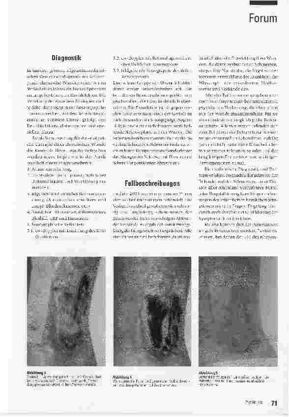 Vorschauseite 2: Die Bedeutung psychischer Faktoren in der Wundbehandlung
