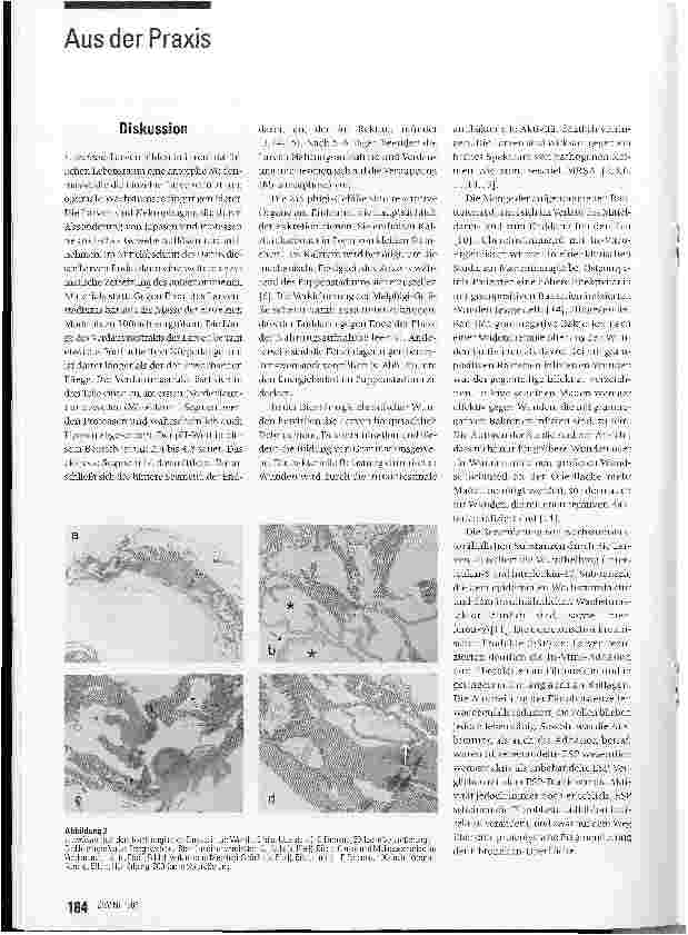 Vorschauseite 3: Die morphologischen Veränderungen von Larven beim Einsatz in der Biochirurgie