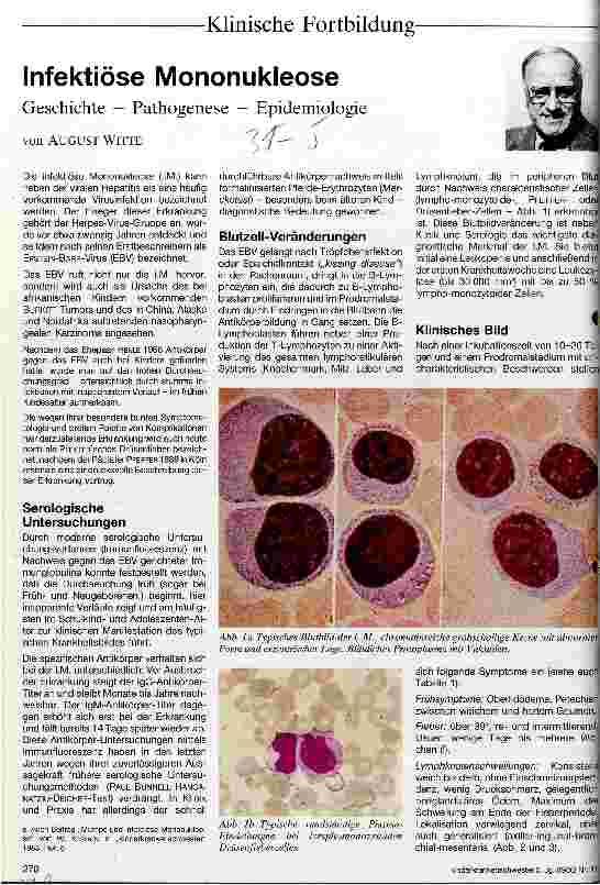 Vorschauseite 1: Infektiöse Mononukleose Geschichte - Pathogenese - Epidemiologie