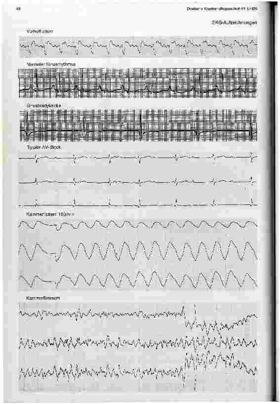 Vorschauseite 2: Überwachung, Betreuung, Ernährung und Physiotherapie des herzoperierten Säuglings und Kleinkindes