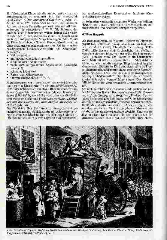 Vorschauseite 3: Alkoholismus und Alkoholembryopathie Darstellung alkoholgeschädigter Kinder in der bildenden Kunst