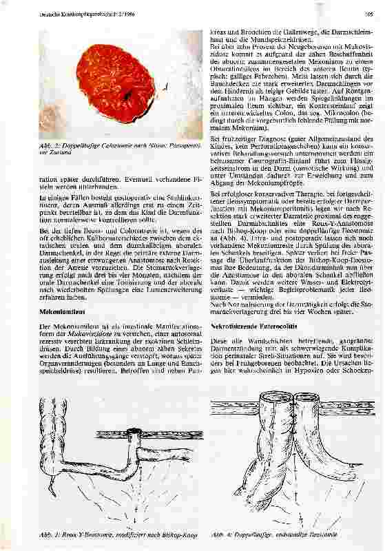 Vorschauseite 3: Enterostomata bei Angeborenen und frühkindlichen erworbenen Darmerkrankungen