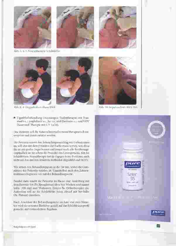 Vorschauseite 4: Hashimoto-Thyreoiditis Fallstudie mit neuraltherapeutischem, osteopathischem und immunmodulatorischem Behandlungskonzept