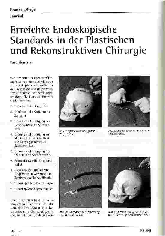 Vorschauseite 1: Erreichte Endoskopische Standards in der Plastischen und Rekonstruktiven Therapie