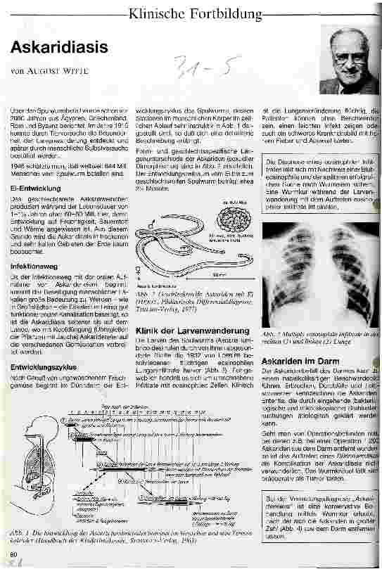 Vorschauseite 1: Askaridiasis
