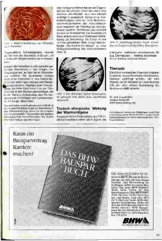 Vorschauseite 2: Askaridiasis