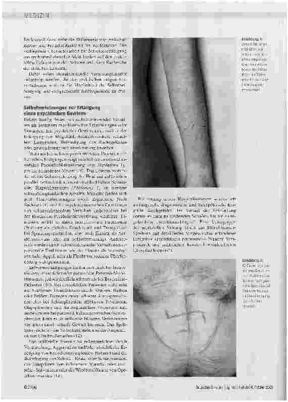 Vorschauseite 3: Selbstbeschädigung - eine rechtsmedizinische Betrachtung
