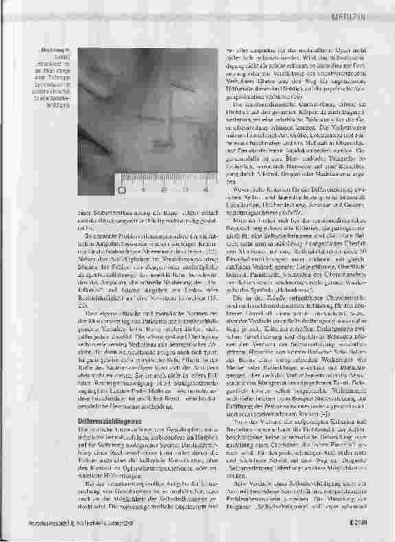 Vorschauseite 6: Selbstbeschädigung - eine rechtsmedizinische Betrachtung