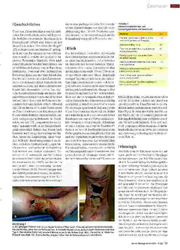 Vorschauseite 2: Ulcus hypertonicum Martorell