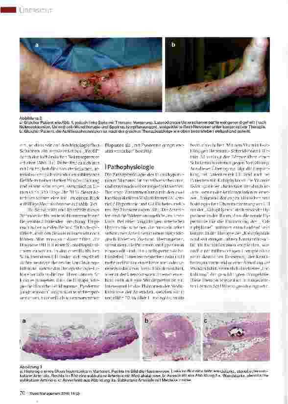 Vorschauseite 3: Ulcus hypertonicum Martorell