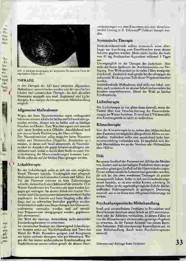 Vorschauseite 4: Klinik und Therapie der atopischen Dermatitis
