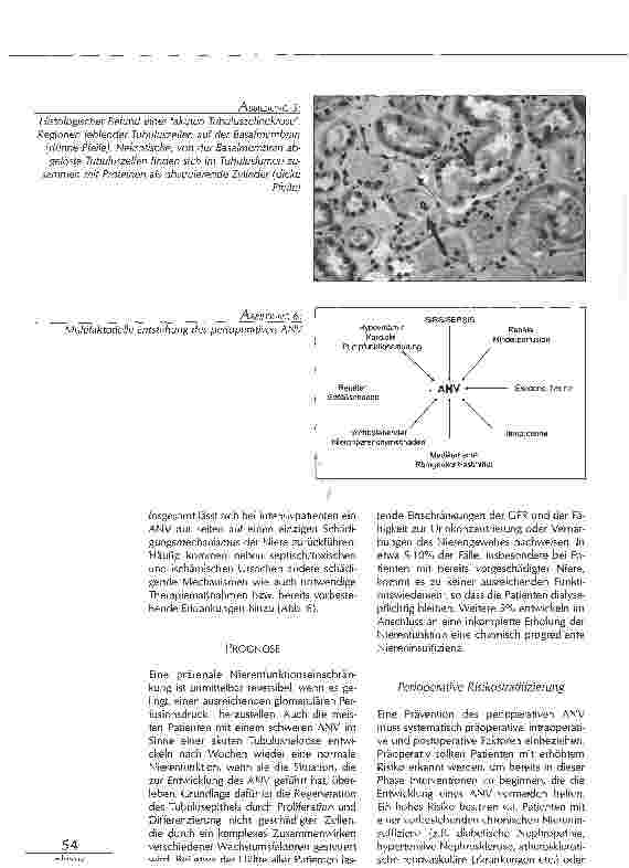 Vorschauseite 5: PERIOPERATIVES AKUTES NIERENVERSAGEN - PATHOPHYSIOLOGIE, PRÄVENTION UND THERAPIE