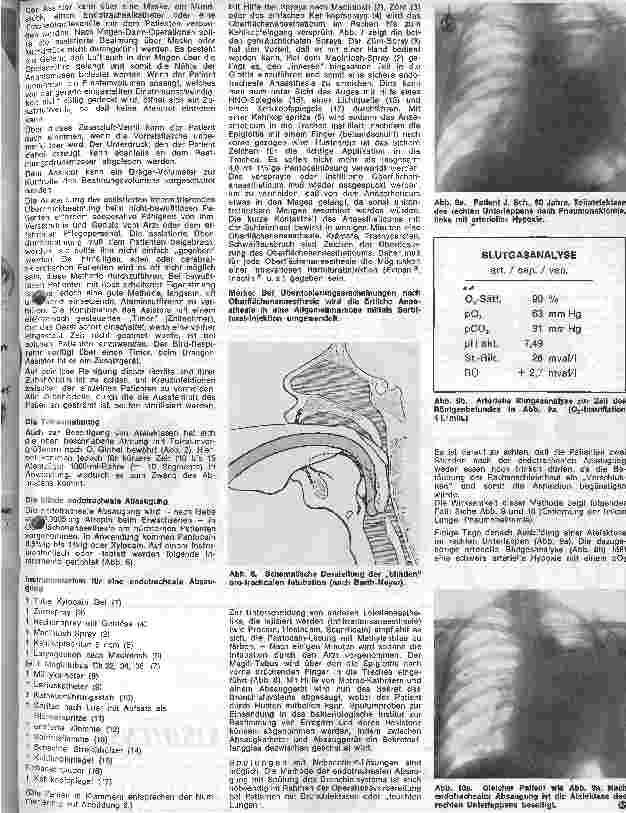 Vorschauseite 4: Ausbildung und Aufgaben der Schwester auf Intensivpflegeabteilung 4. Folge: Therapeutische Maßnahmen bei respiratorischen Störungen