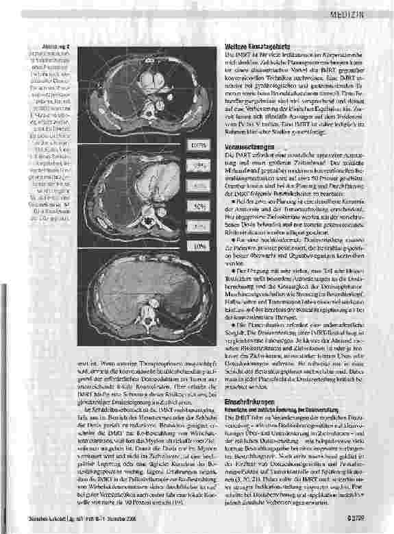 Vorschauseite 5: Intensitätsmodulierte Strahlenbehandlung - neue Perspektiven für die Tumortherapie