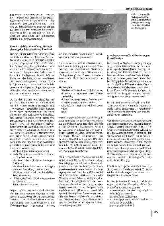 Vorschauseite 2: Kalziumphosphatverbindungen zum Knochenersatz