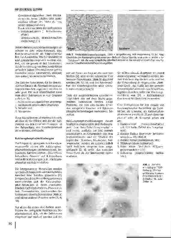 Vorschauseite 3: Kalziumphosphatverbindungen zum Knochenersatz