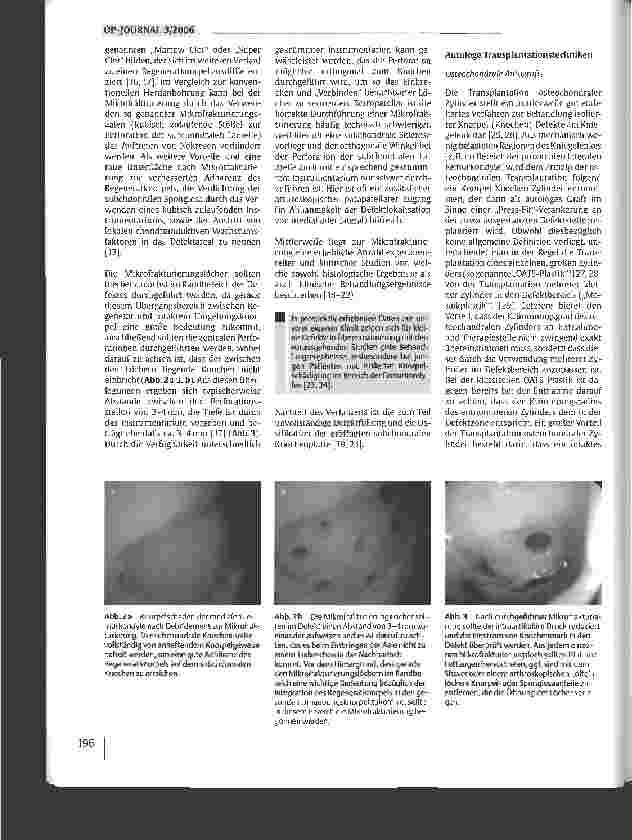 Vorschauseite 3: Operative Behandlung isolierter Knorpelschäden am Kniegelenk