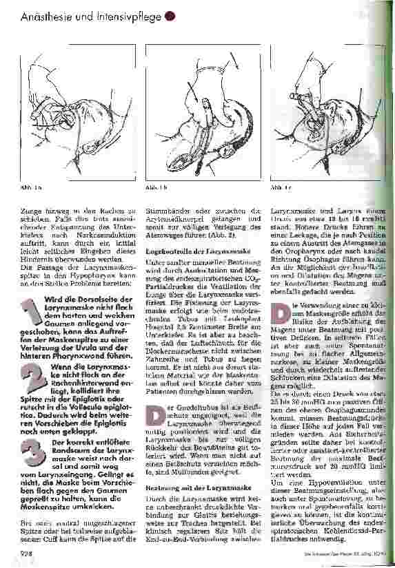 Vorschauseite 2: Die Larynmaske