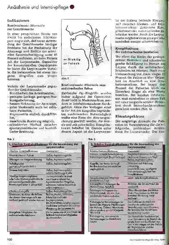 Vorschauseite 3: Die Larynmaske