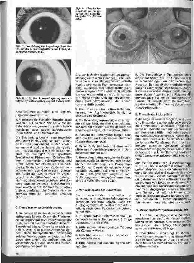 Vorschauseite 3: Einführung in die Augenheilkunde 8. Folge: Erkrankungen der Gefäßhaut