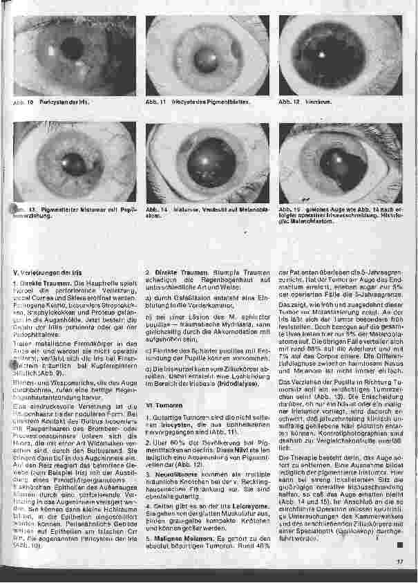 Vorschauseite 4: Einführung in die Augenheilkunde 8. Folge: Erkrankungen der Gefäßhaut