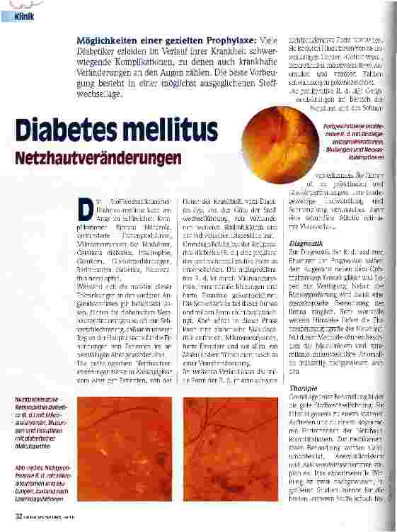 Vorschauseite 1: Diabetes mellitus Netzhautveränderungen