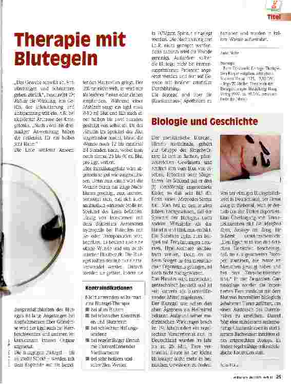 Vorschauseite 2: Therapie mit Blutegeln