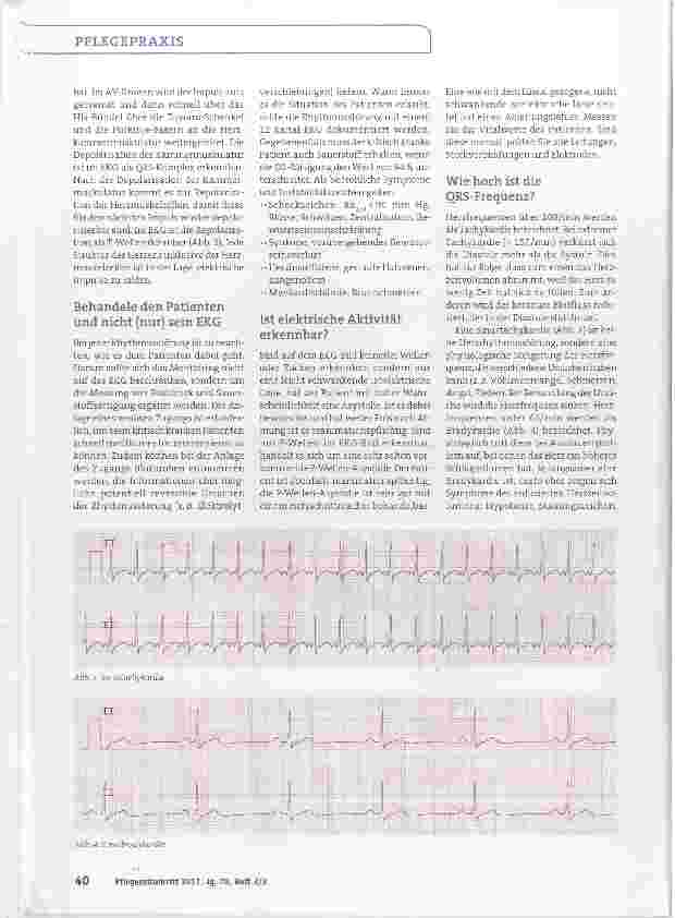 Vorschauseite 2: Interpretation des Monitor-EKGs-leicht gemacht