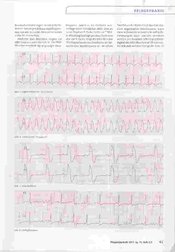Vorschauseite 3: Interpretation des Monitor-EKGs-leicht gemacht