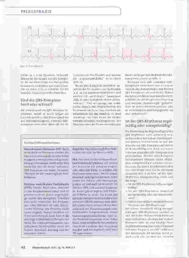 Vorschauseite 4: Interpretation des Monitor-EKGs-leicht gemacht