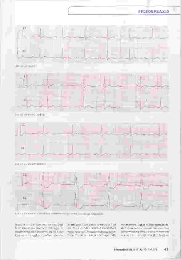Vorschauseite 5: Interpretation des Monitor-EKGs-leicht gemacht