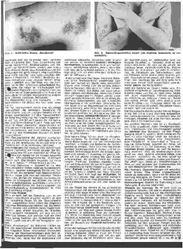 Vorschauseite 2: Der hautkranke Patient 6. Folge Spezielle Dermatologie: Ekzeme und Unverträglichkeitsreaktionen III