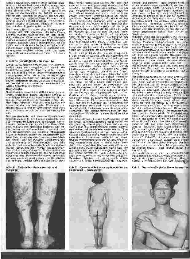 Vorschauseite 3: Der hautkranke Patient 6. Folge Spezielle Dermatologie: Ekzeme und Unverträglichkeitsreaktionen III